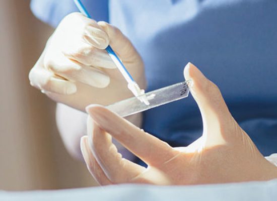 Δωρεάν Τεστ ΠΑΠ